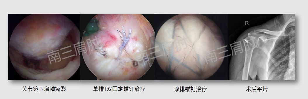 图片11.png