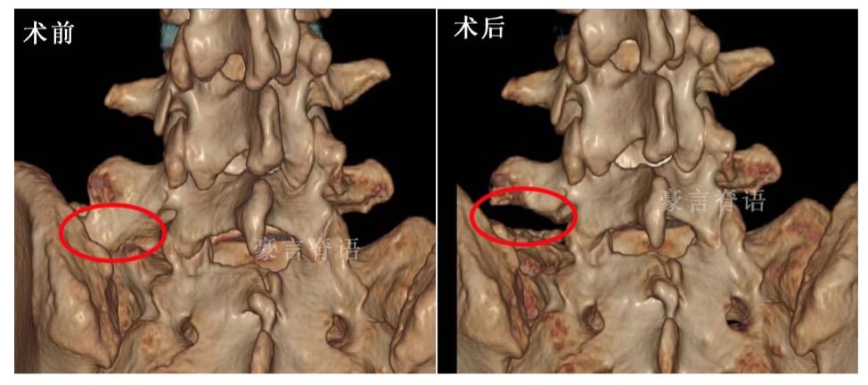术前术后.jpg
