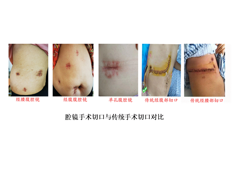 幻灯片5.GIF