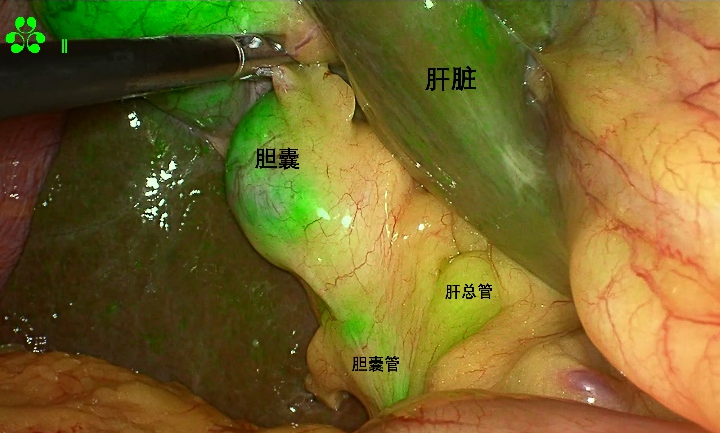 图2.png