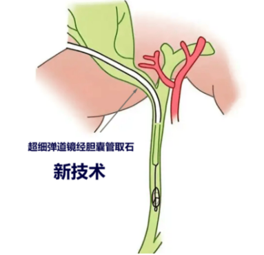 640 (1).png