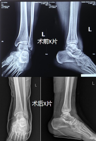 足踝外科又获患者锦旗致谢2.jpg