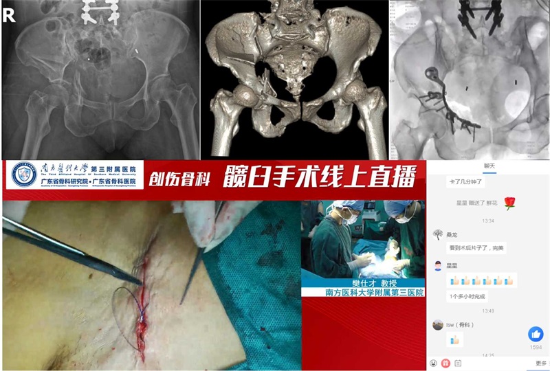 图2 第二台手术影像资料.jpg